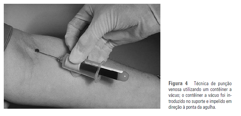 exame de sangue de veias finas